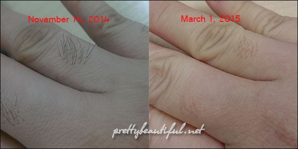 finger